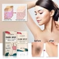 thumbnail image 5 of Crema blanqueadora para eliminar manchas oscuras y Corrector, crema suave y segura para aclarar la piel, crema blanca para las axilas y el cuello, 5 of 5