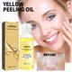 thumbnail image 3 of Aceite esencial blanqueador y eliminador de manchas, exfoliante, blanqueador e hidratante de la piel, 50 ml a essence, 3 of 5