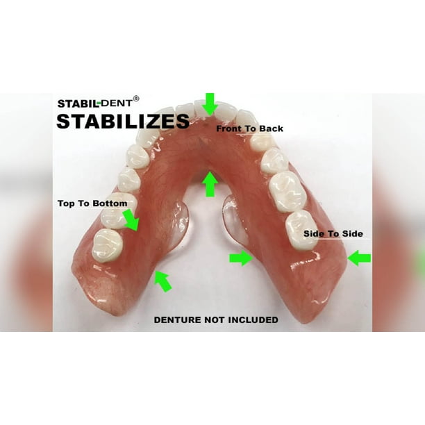 StabilDent Do It Yourself Lower Denture Stabilizer Kit