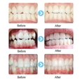 thumbnail image 4 of 2pcs Children Dental Tooth Orthodontic Appliance Trainer Kids Alignment Braces, 4 of 5