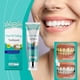 thumbnail image 5 of Xihbxyly Pasta Dental Blanqueadora, Fórmula Antimanchas Que Ilumina La Sonrisa, Protege El Esmalte para Una Dentadura Sana, Mejora El Aliento Fresco, Cuidado Bucal Diario, para Adultos y Adolescentes, 5 of 7