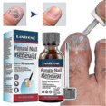 thumbnail image 1 of Extra Strength Anti-Fungal Nail Liquid - Repair Grey, Discolored & Thick Nails, Quick Absorption Nail Strengthening Liquid for All Nail Types, 1 of 4