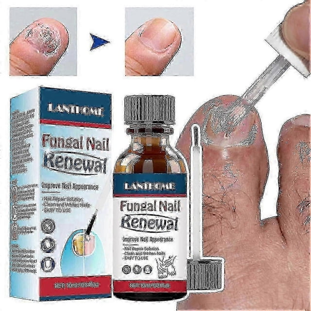 Extra Strength Anti-Fungal Nail Liquid - Repair Grey, Discolored & Thick Nails, Quick Absorption Nail Strengthening Liquid for All Nail Types
