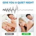 thumbnail image 6 of Anti Snoring Mouthpiece - AdjustableAnti Snoring Device - Anti Snoring Mouth Guard Helps Stop Snoring - Comfortable Snoring Solution for Men/Women Night's Sleep., 6 of 9