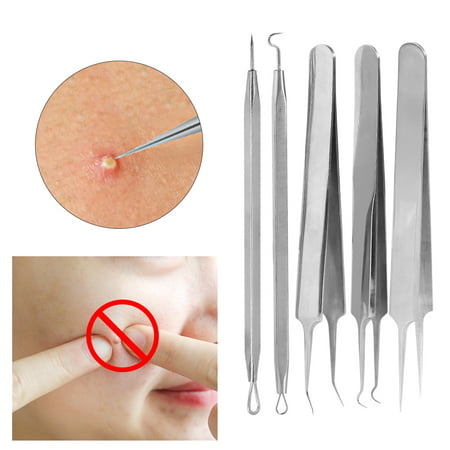 Yosoo Blackhead Acne Remover Kit, 5-in-1 Pimple Extractor Acne Comedone Blackhead Acne Removal Tool Set, Treatment for Blemish, Whitehead, Zit Removing with Metal