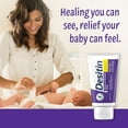 thumbnail image 5 of Desitin Maximum Strength Baby Diaper Rash Cream, Travel Size, 2 oz, 5 of 11