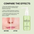 thumbnail image 3 of Fiudx Limpiador Facial, Gel de Ducha Profundamente Hidratante, Ingredientes Naturales Suaves, Calmante para Piel Sensible, Hidratación Intensa, Iluminador, para Todo Tipo de Piel, 100 Ml de Capacidad, 3 of 6