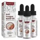 thumbnail image 1 of aceites Mardi Gras 2024, aceite de alivio, aceite reparador para uñas dañadas, aceite para aliviar la paroniquia, 10 ml Lucky_B, 1 of 5