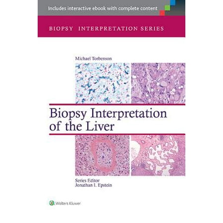 Biopsy Forcep - Biopsy Interpretation of the Liver - eBook
