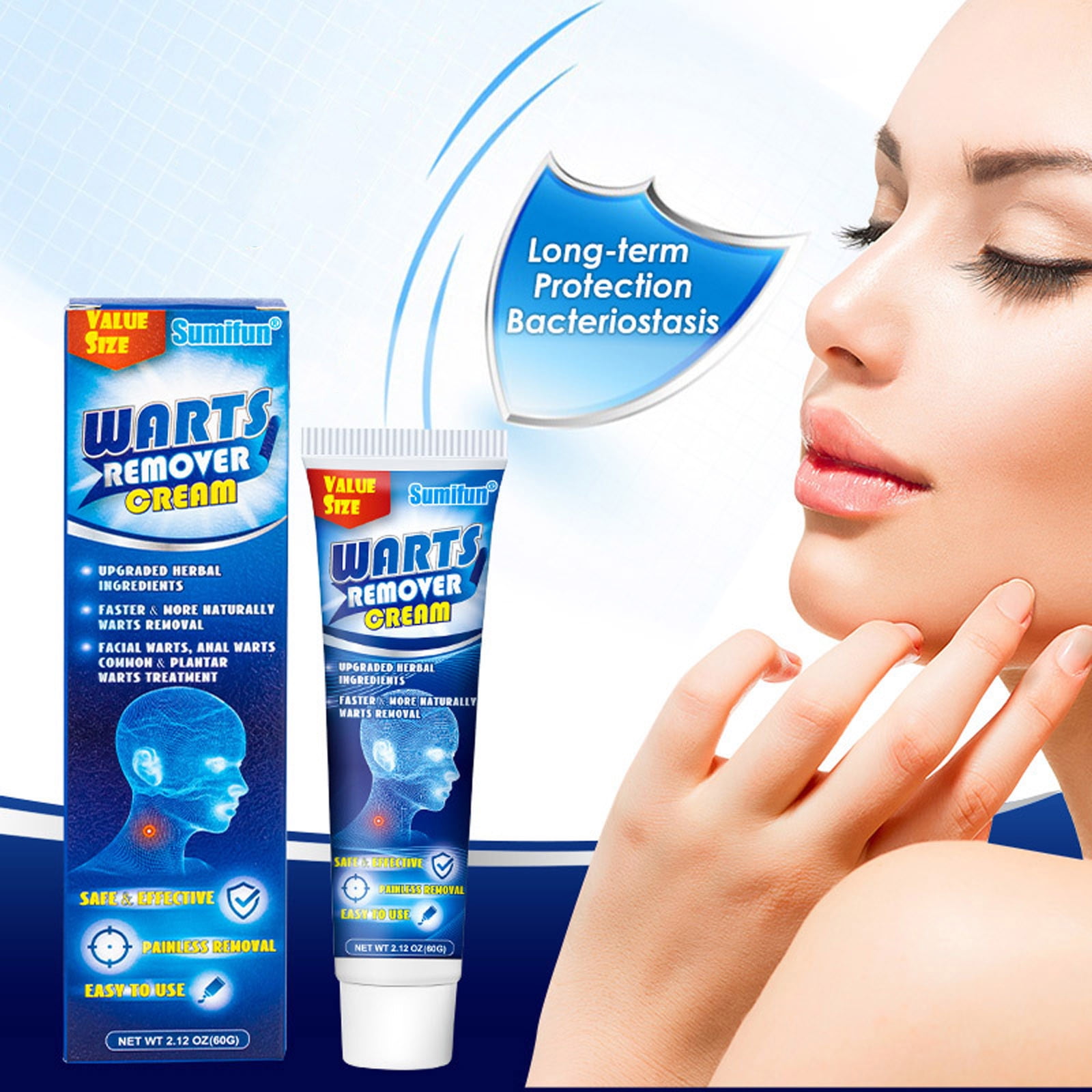 Cheerom 20G G Wart Cream Wart Flat Corn Eye Ointment Flat Wart Wart On