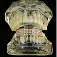 thumbnail image 5 of 14k Gold Plated Best Grillz Four Row Bling Teeth 4 Rows Bottom Hip Hop Grills, 5 of 6