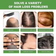 thumbnail image 2 of Eelhoe Rosemary Shampoo Deep Cleansing Massage Scalp Moisturizing Soft Thick Conditioning Shampoo -8440963343172, 2 of 4