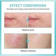 thumbnail image 4 of Hypochlorous Acid Spray Face, Daily Res-cue Facial Spray 30ml, 4 of 5