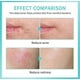 thumbnail image 4 of Hypochlorous Acid Spray Face, Daily Res-cue Facial Spray 30ml, 4 of 5