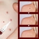 thumbnail image 5 of Clean Remover Fast Remove All Moles Warts Spots Freckles Foot Corn Removal Warts Papillomas Rapidly Remove Moles 3ml, 5 of 5