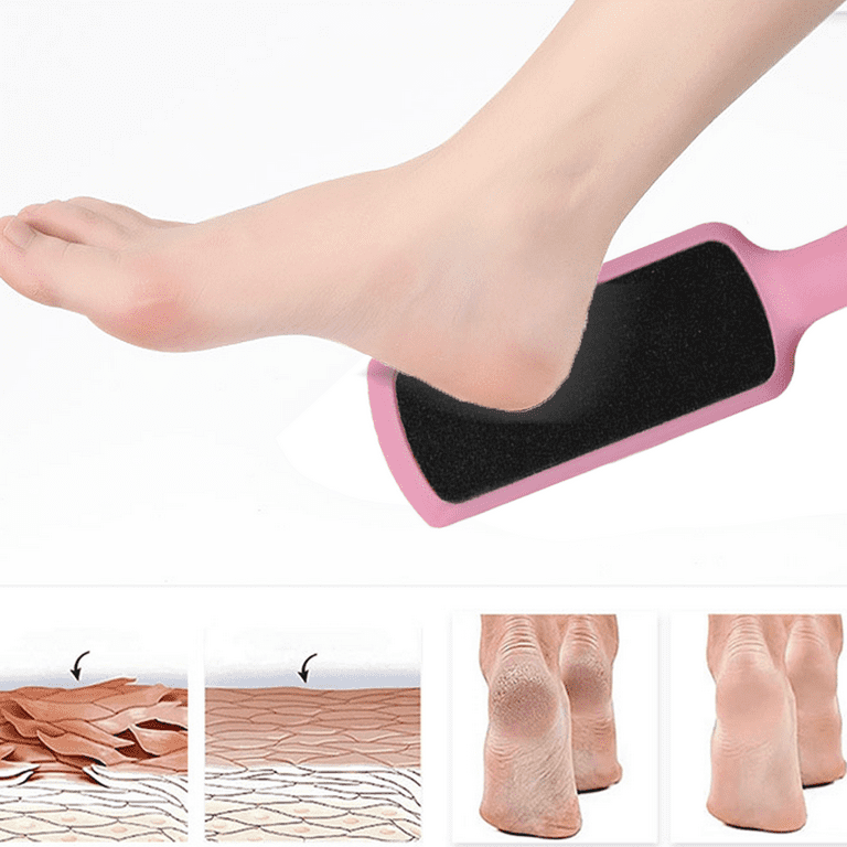 Kinepi Foot File Callus Remover Foot Scrubber,Professional Pedicure Foot  Rasp Removes Cracked Heels,Dead Skin,Corn,Hard Skin,Pumice Stone for  Scraper