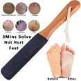 thumbnail image 1 of Foot File Callus Remover Foot Scrubber,Professional Pedicure Foot Rasp Removes Cracked Heels,Dead Skin,Corn,Hard Skin,Pumice Stone for Feet Scraper File Brush Tools for Wet and Dry Feet, 1 of 4