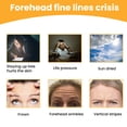 thumbnail image 3 of 2pcs Forehead Wrinkle Patch, Lifts Lightens And Smooths Forehead Wrinkles Facial Skin Forehead Patch, 3 of 5