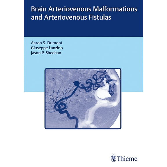 Brain Arteriovenous Malformations and Arteriovenous Fistulas (Hardcover)