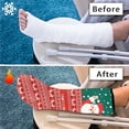 thumbnail image 7 of COEQINE Christmas Leg Cast Covers Size M 2 Packs Santa Claus Stylish Cast Socks Cover Leg Cast Protector Outdoor Protection Leg Cover Soft Cast Decoration Christmas Gifts for Kids Girls, 7 of 7