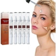 thumbnail image 1 of Wipe Off Tags And Mole Remover, Skin Tag Remover Liquid, Effectively Remove Skin Tags -3ml, 1 of 1