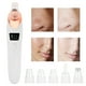thumbnail image 4 of Limpiador Facial Eléctrico, Limpiador De Poros útil Para Mujeres, Para Pieles Frágiles, Chupa Puntos Negros Ccdes Otros, 4 of 8