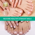 thumbnail image 4 of 30ml Toenail Fungus Oil Nail Care Repair Liquid para blanqueamiento antihongos Ndcxsfigh  Cuidado Belleza, 4 of 6