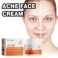 Salicylic Acid Facial Mask Gentle Cleansing Mask To Lighten Acne, Seal