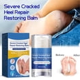 thumbnail image 3 of Cracked Feet Cream, 2pcs 40g Easy Apply Cracked Heel Repair Cream  for Home Use for All Skin Types, 3 of 7