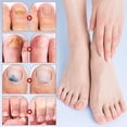 thumbnail image 3 of Parche reparador de uñas KOSIMI Extra Strength, 21 unidades, 3 of 4