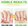 thumbnail image 4 of Stop Nail Biting Treatment, Bitter-Tasting Nail Polish, Easy to Apply and Safe for Children & Adults - Nail Care for Healthy Nail Be Longer 7ml - 3Pack, 4 of 9