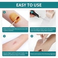 thumbnail image 5 of QARUN Hydrocolloid Roll for Wound Care,Pimple Patch Roll Tape Medical Grade Bandages for Acne,Blisters,Burn Self-Adhesive Ultra Absorbent Flexible Waterproof 2In Width Diy Size(2In*16Ft), 5 of 7