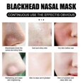 thumbnail image 2 of Blackhead Removal Nasal Mask Gently And Deeply Cleans Pores To Suck Blackheads And Acne Comes With 60 Sheets Of Tear-off Nose M, 2 of 5