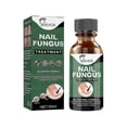 thumbnail image 1 of 50ml Nail Fungus Treatment Solution Extracts Remove Onychomycosis No Yellowing Restore Shine Nail Repair Care, 1 of 5