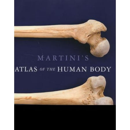 Martini's Atlas of the Human Body (ME Component) [Spiral-bound - Used]