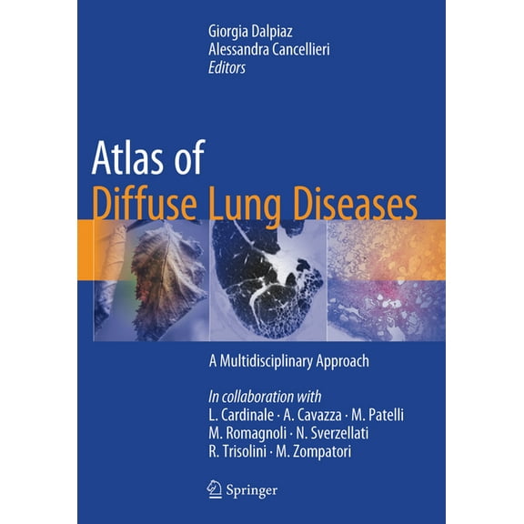 Atlas of Diffuse Lung Diseases: A Multidisciplinary Approach, (Hardcover)