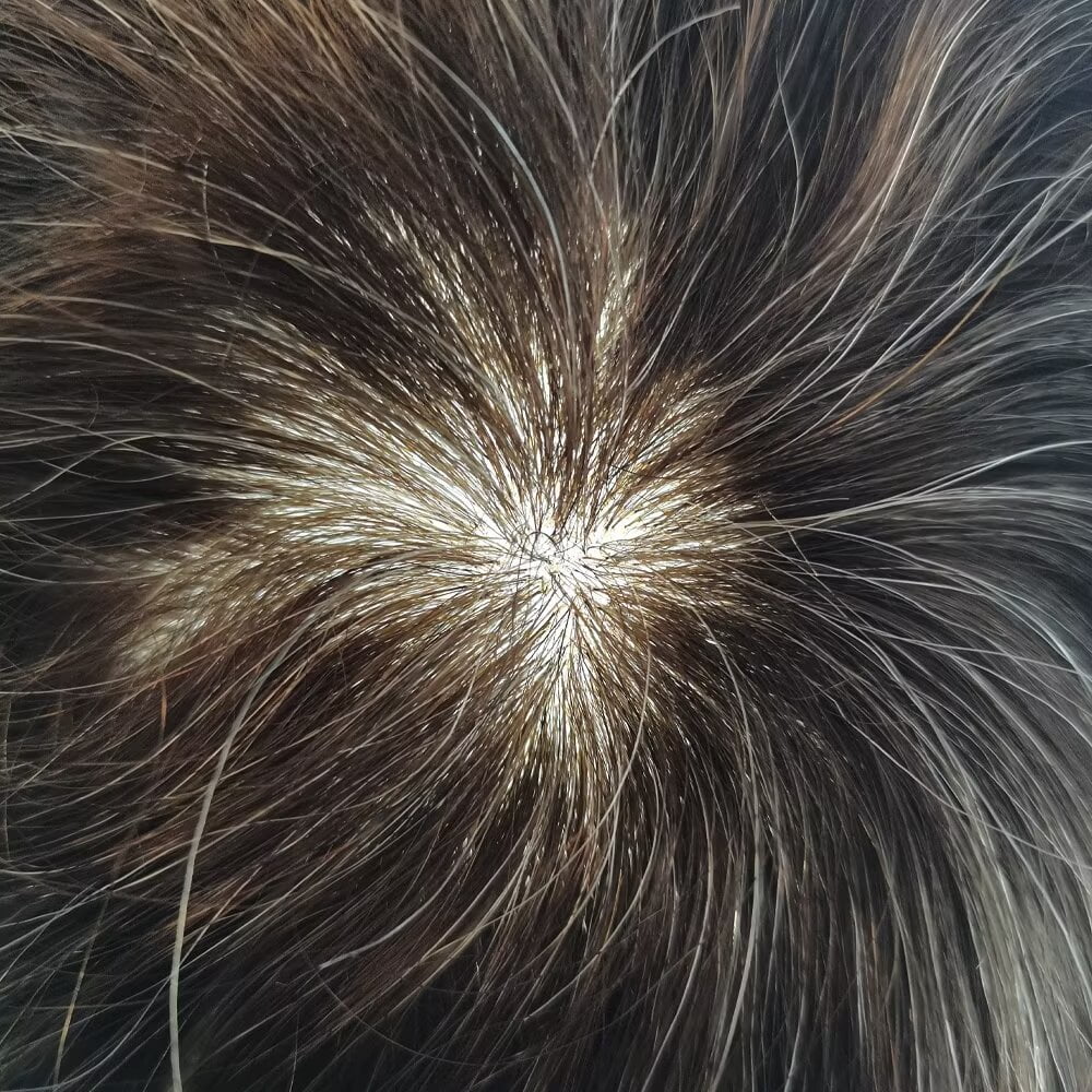 LYRICAL HAIR Toupee Hair for Men Thin Skin Mens Toupee Human Hair Replacement System 7"X9" All Poly Mens Hairpiece PU Injected Mens Wig Units