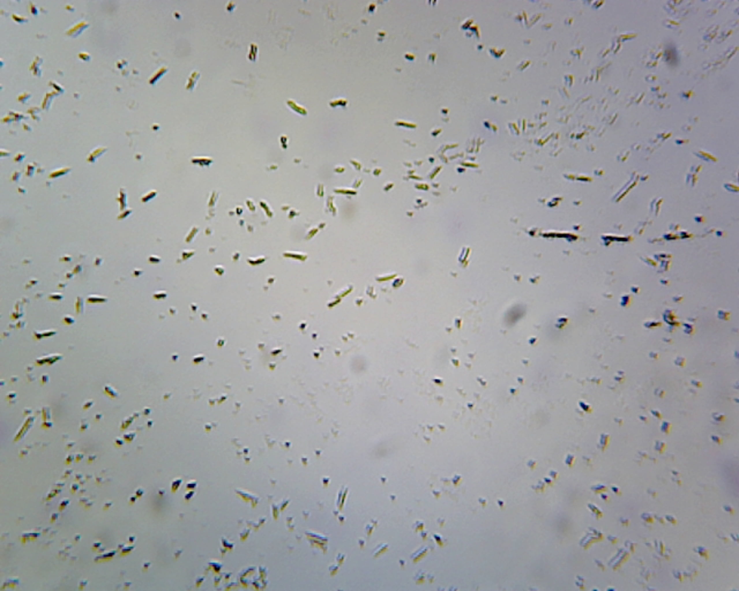 Clostridium Botulinum, SporeForming Anaerobic Rods; Smear; Gram