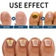 thumbnail image 2 of Ungüento para el cuidado de las uñas Gel de eliminación de hongos para las uñas de los dedos de los pies Esencia nutritiva para el cuidado de las uñas Ndcxsfigh Cuidado Belleza, 2 of 4