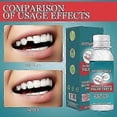 thumbnail image 3 of tooth repair kit for DIY dental fixes, 3 of 5
