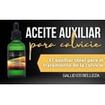 thumbnail image 2 of Set de 10 Botellas de Bálsamo Auxiliar en Tratamiento de Calvicie Josue Echavarria Natural, 2 of 6