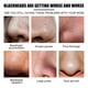 thumbnail image 1 of West & Month Blackhead Stickers 10PCS, 1 of 4