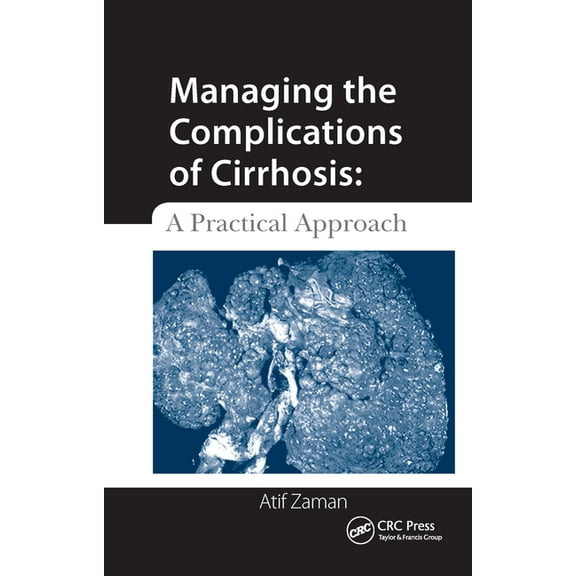 Managing the Complications of Cirrhosis: A Practical Approach, (Paperback)