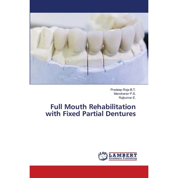 Full Mouth Rehabilitation with Fixed Partial Dentures (Paperback)