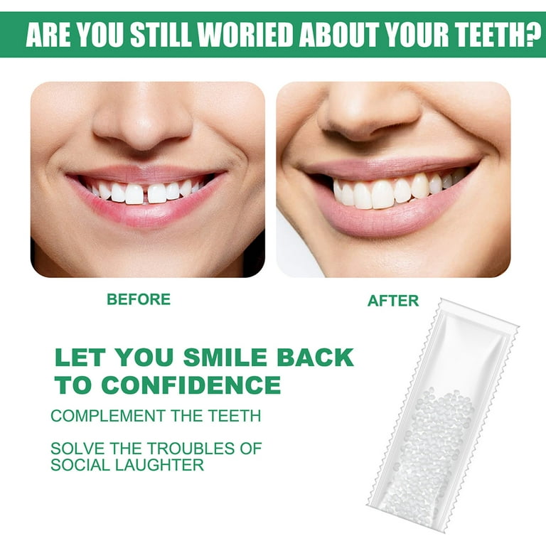 Resin Temporary Tooth Repair Kit Teeth And Gaps FalseTeeth Solid Glue  Denture Adhesive Teeth Whitening Tooth
