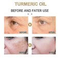 thumbnail image 5 of 30ml Turmeric Oil Pure Natural Moisturizing Anti-aging Serum, 5 of 5