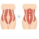 thumbnail image 3 of BR Cinturón abdominal de neopreno ajustable - Negro, 78-83 cm, soporte deportivo para la espalda y cinturón adelgazante, 3 of 5