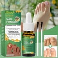 thumbnail image 4 of Anti-Fungals Nail Repair Spray Quick Absorption Nail Strengthening Liquid Nails Care Supplies, 4 of 5