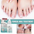 thumbnail image 2 of 10ml Fungal Nail Treatment Nail Foot Whitening Toe Fungus Removal Feet Care Repair Nail For O, 2 of 5
