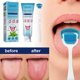 thumbnail image 3 of Tongue Coating Cleaning Gel Set Fresh Remove Oral Odor To Cleaner for Bad Breath, 3 of 5